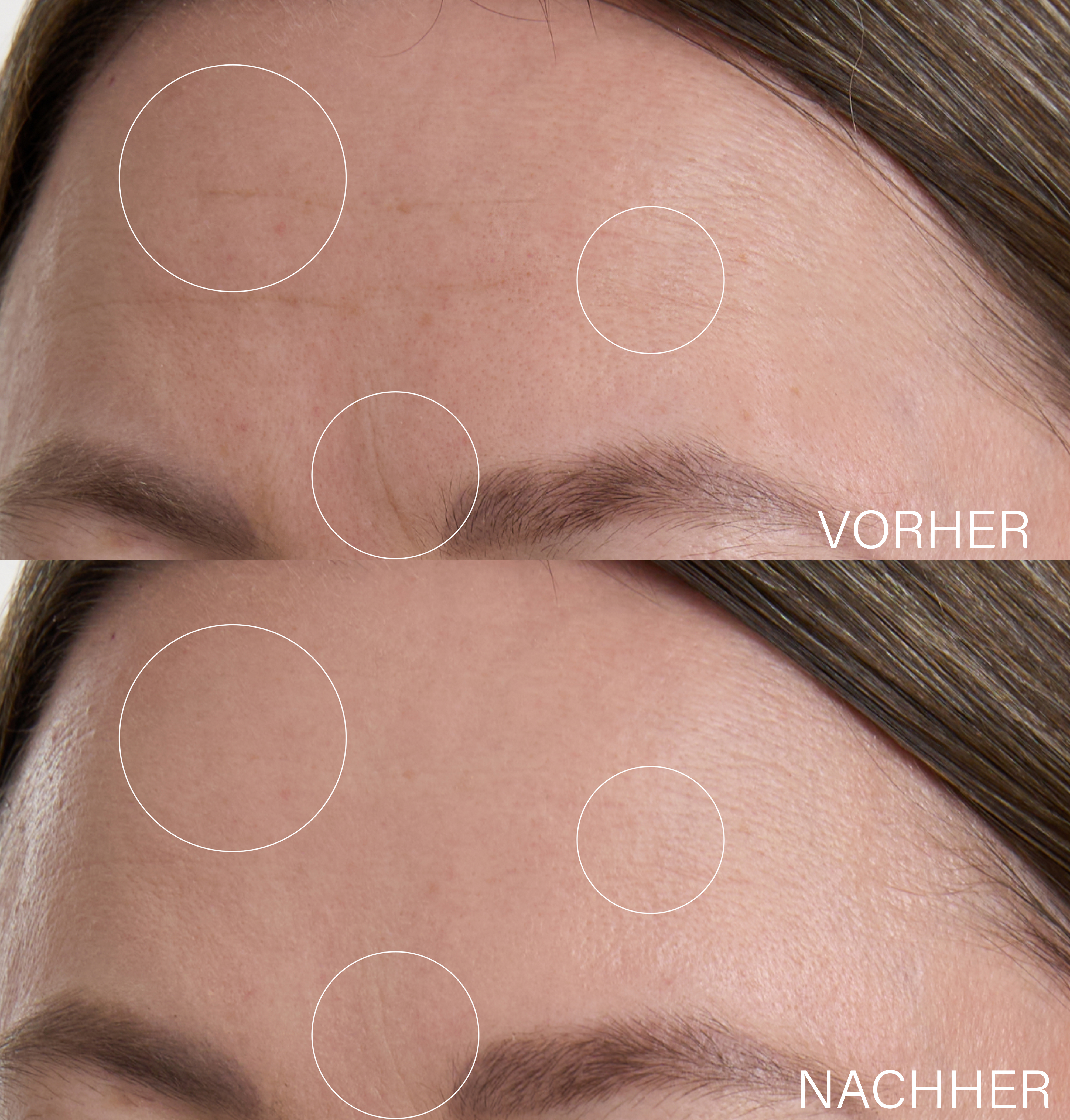 Botanical Lifting Effect Serum | with Hyaluron