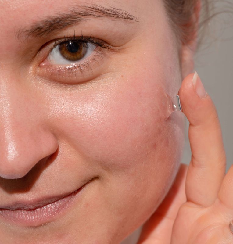 Siero antiacne con zinco, olio dell'albero del tè e probiotici